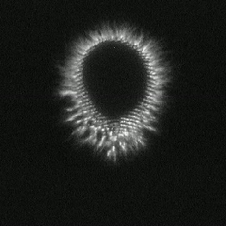 Couronne GDV dense et étendue, avec des stries marquées vers le bas.